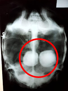 sinar rongten bladder stone sulcata