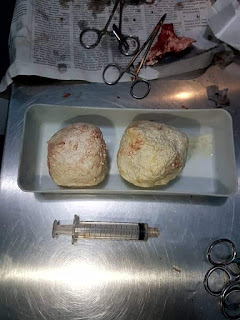 oprasi bladder stone pada kura kura